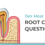 10 most popular root canal questions