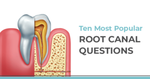 10 most popular root canal questions